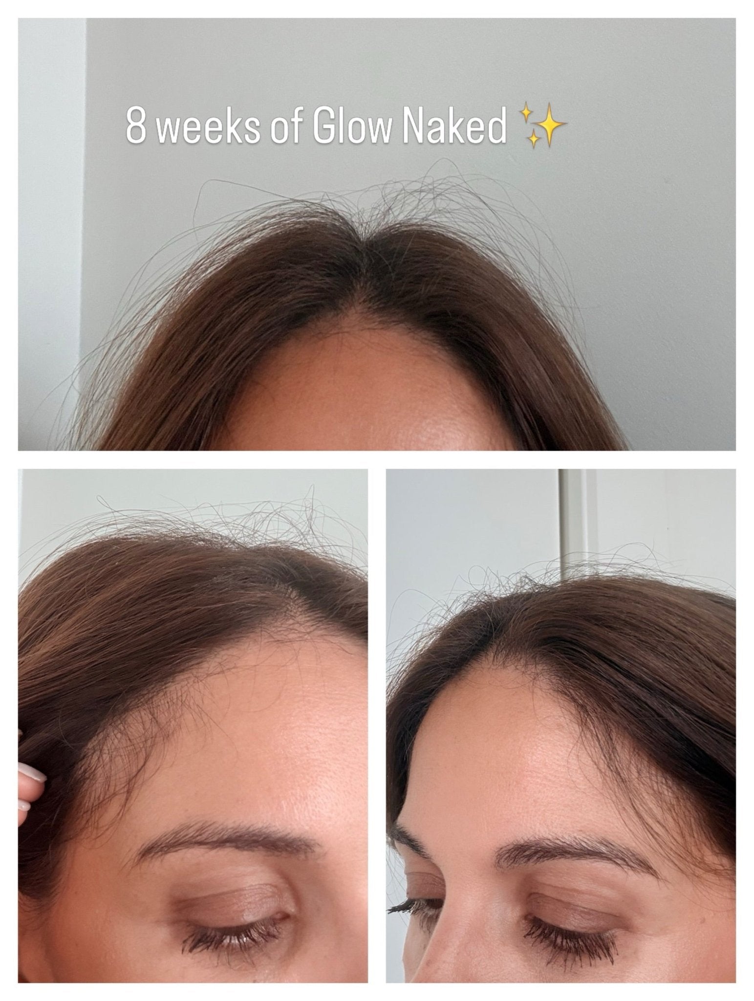 Collagen, Hair Growth & Longevity: What Happened After 8 Weeks of NEE-V
